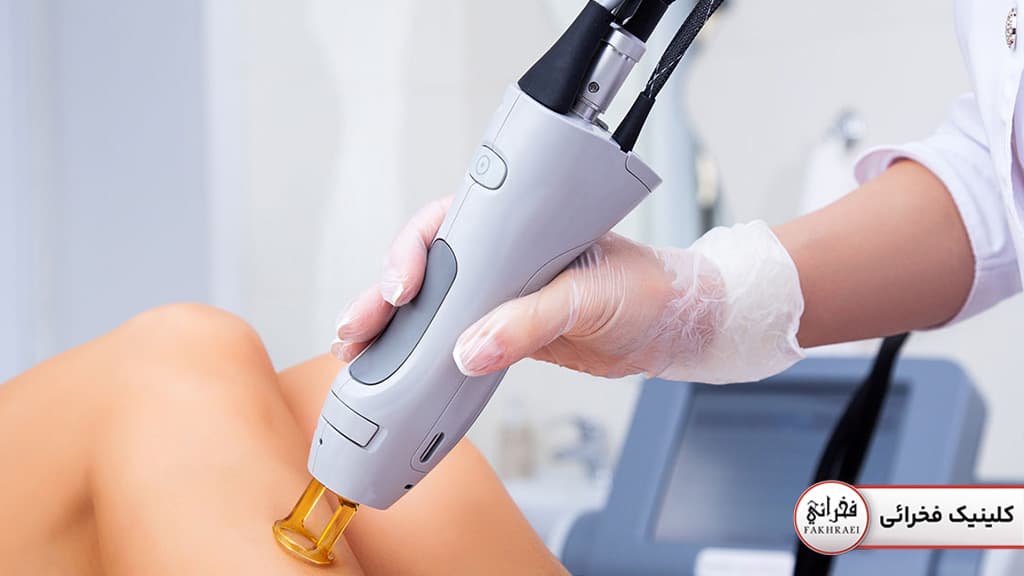 انواع لیزرهای زیبایی: دستگاه لیزر کندلا