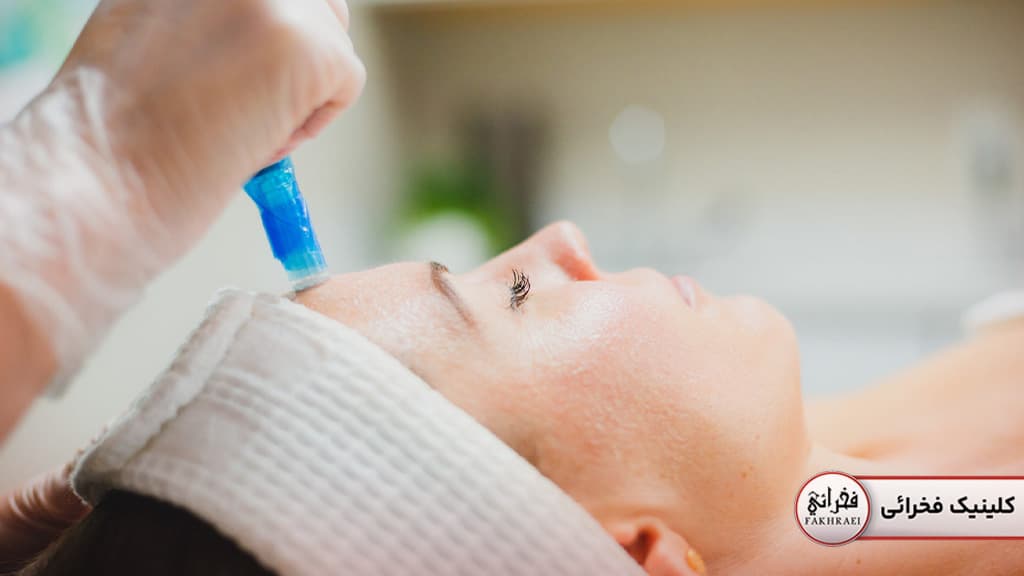 مزیت‌ها و معایب میکرونیدلینگ