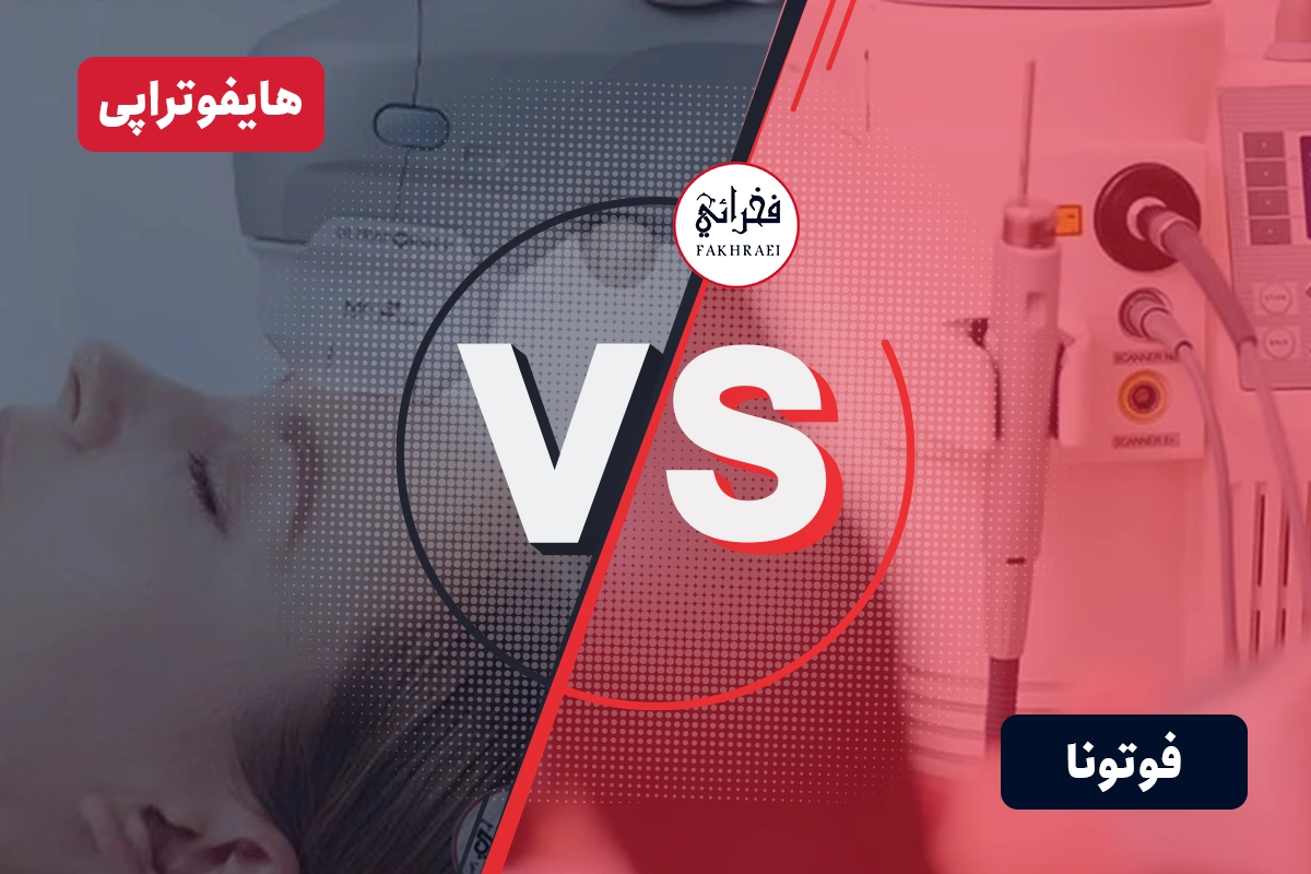 تفاوت فوتونا و هایفو