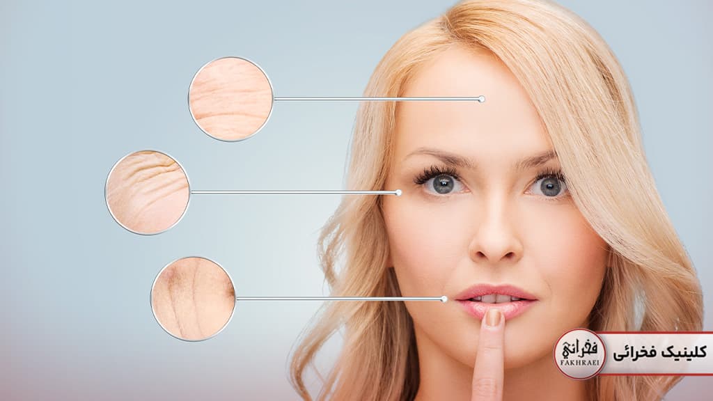 رفع چین و چروک با هایفو