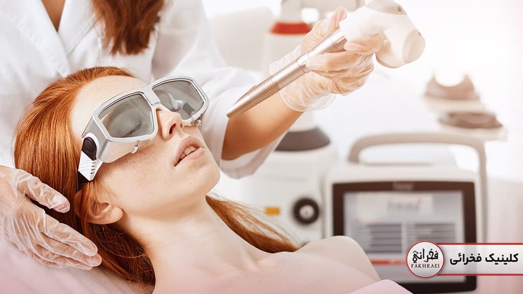 مراحل لیزر فوتونا