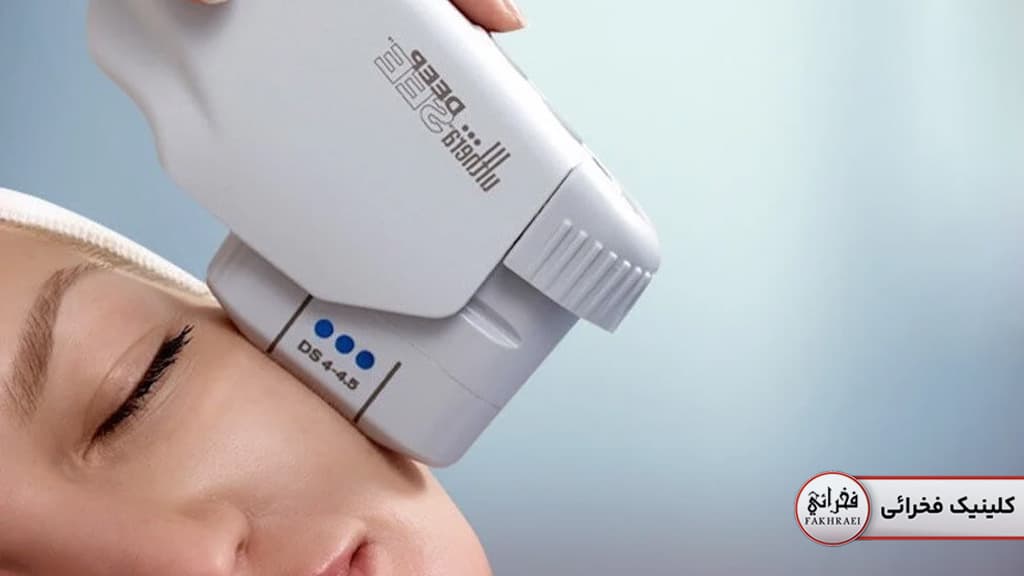 جوانسازی با هایفو | مقایسه هایفو و میکرونیدلینگ