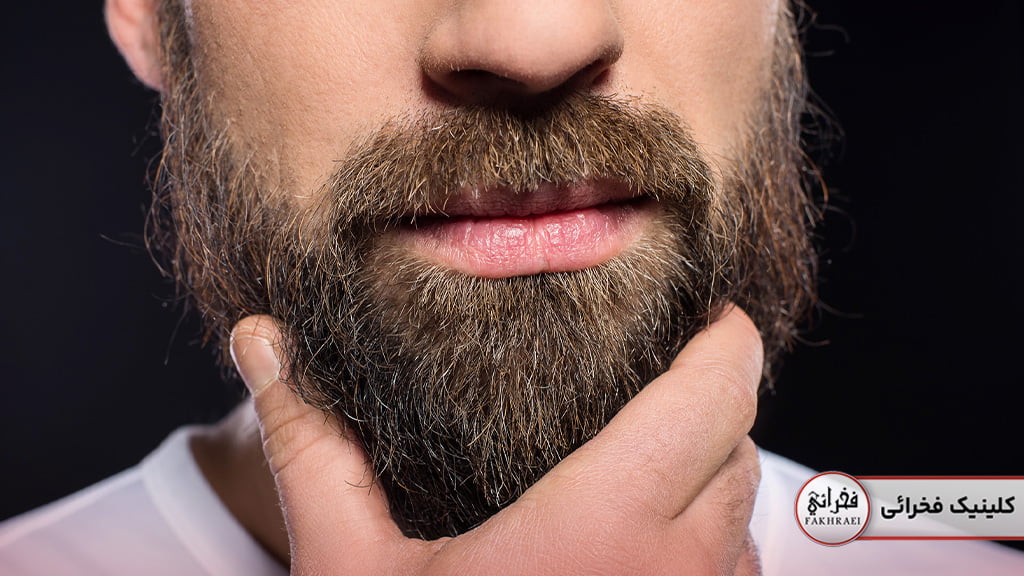 سن طبیعی درآمدن ریش در آقایان