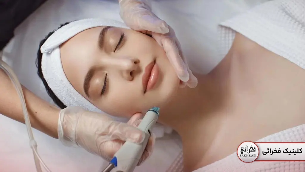 لیزر کیوسوییچ روی پوست صورت- زنی با چشمان بسته در حال انجام کیوسوئیچ