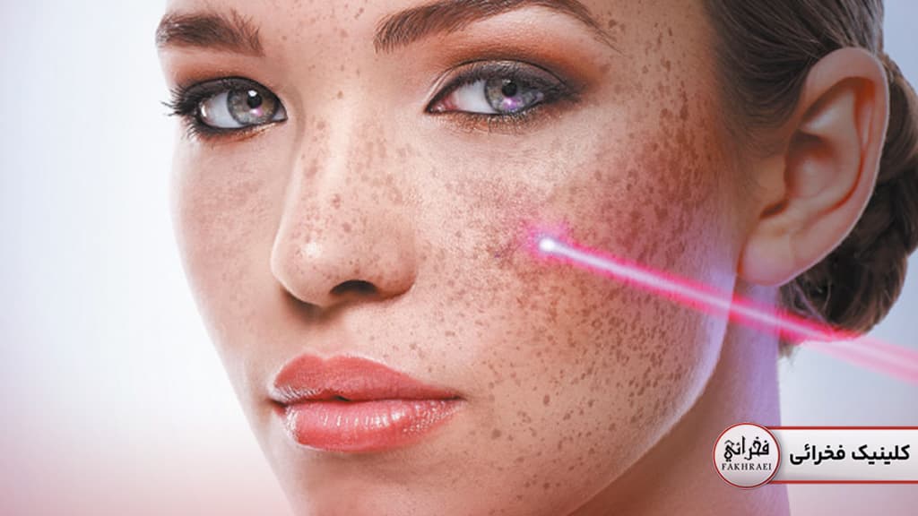 کاربرد انواع لیزر زیبایی