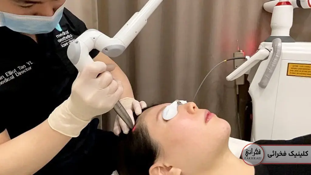 لیزر فوتونا برای موی سر