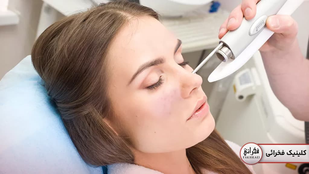 لیزر جوانسازی پوست