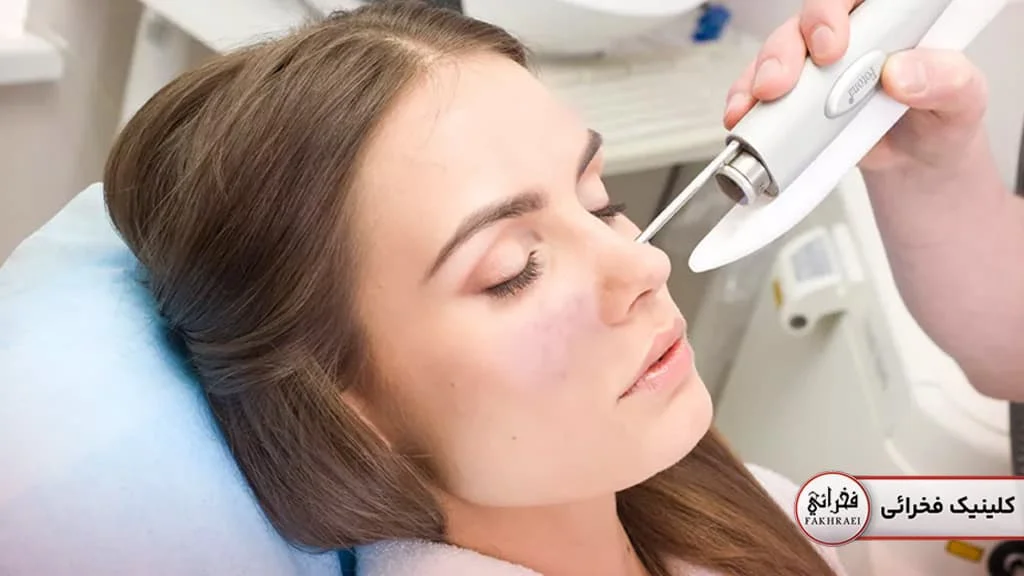 لیزر جوانسازی پوست