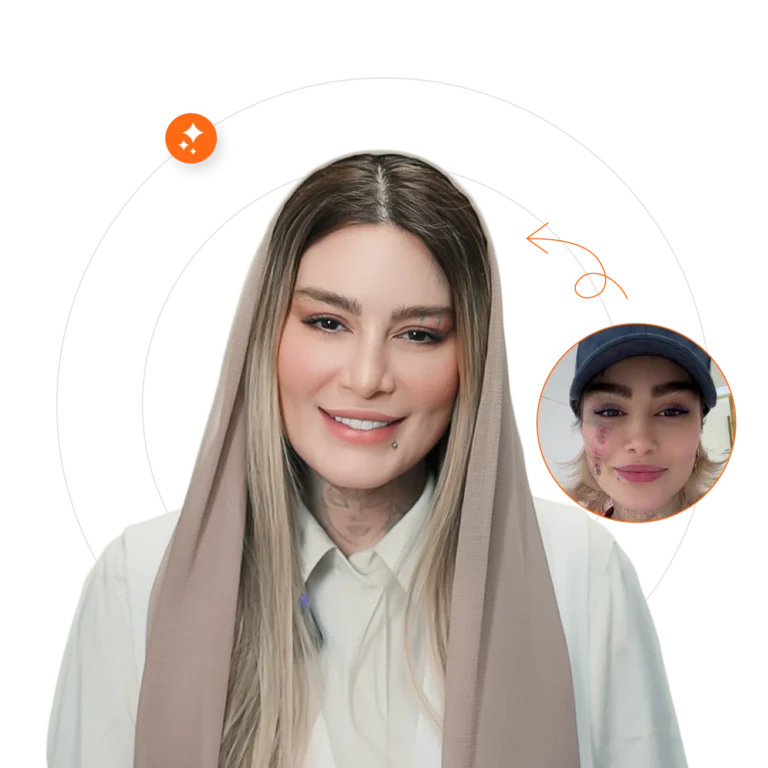 پاک کردن تاتو با لیزر