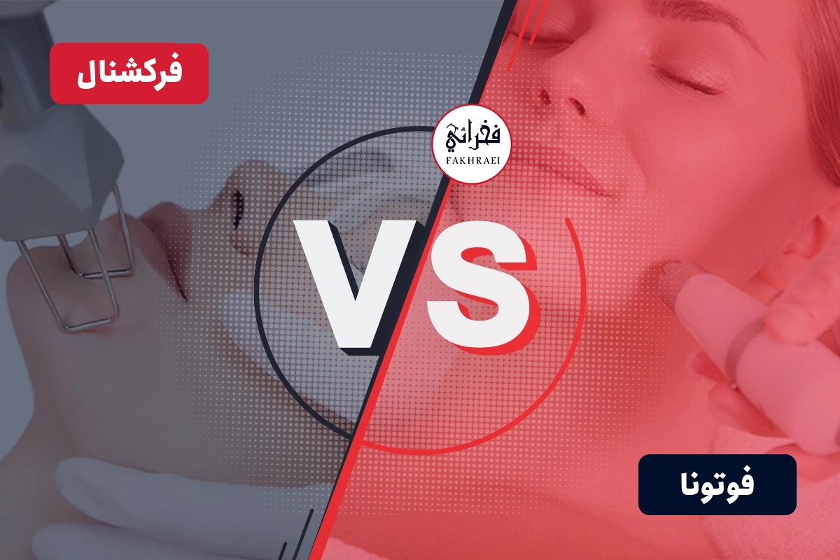 تفاوت لیزر فوتونا و فرکشنال