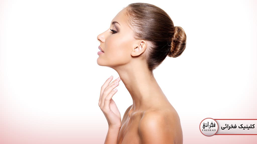 مقایسه فوتونا و اندولیفت