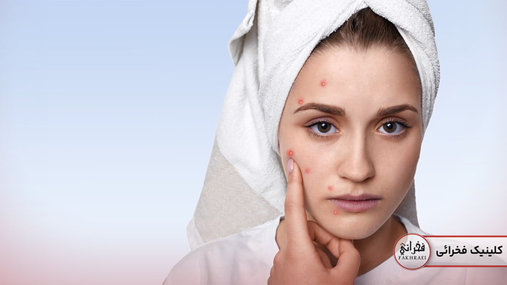 لیزر فوتونا برای جای جوش