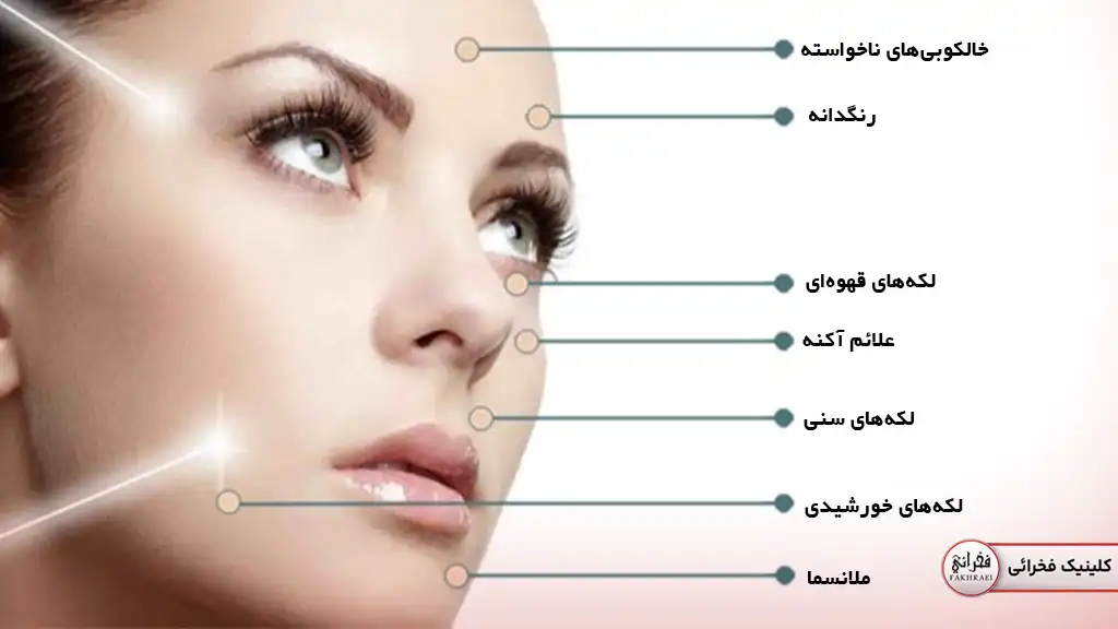 مناطق مورد استفاده در کیوسوئیچ