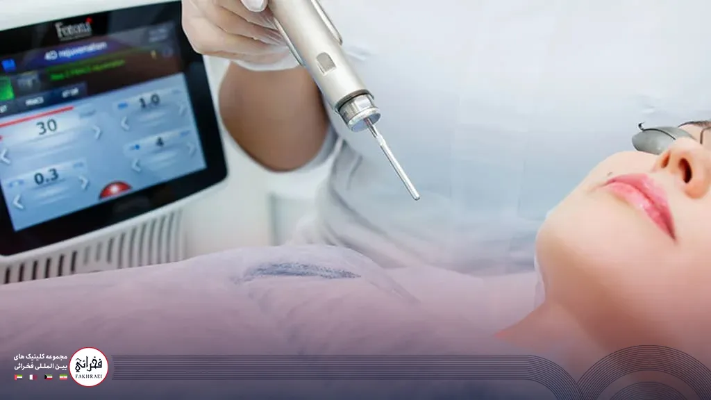 جوانسازی پوست با لیزر فوتونا