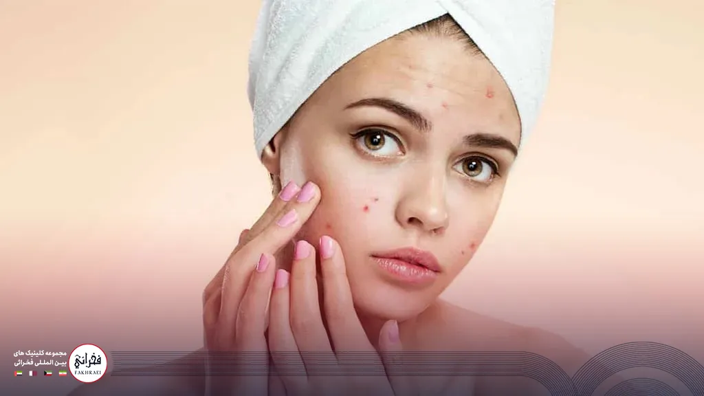 لیزر CO2 برای جای جوش