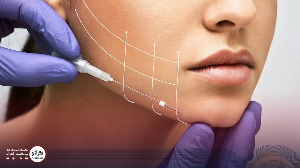 لیفت صورت با نخ چیست
