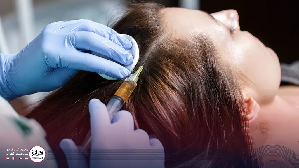 تزریق پی آر پی به سر