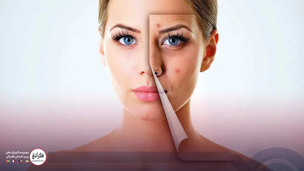 فیشیال صورت