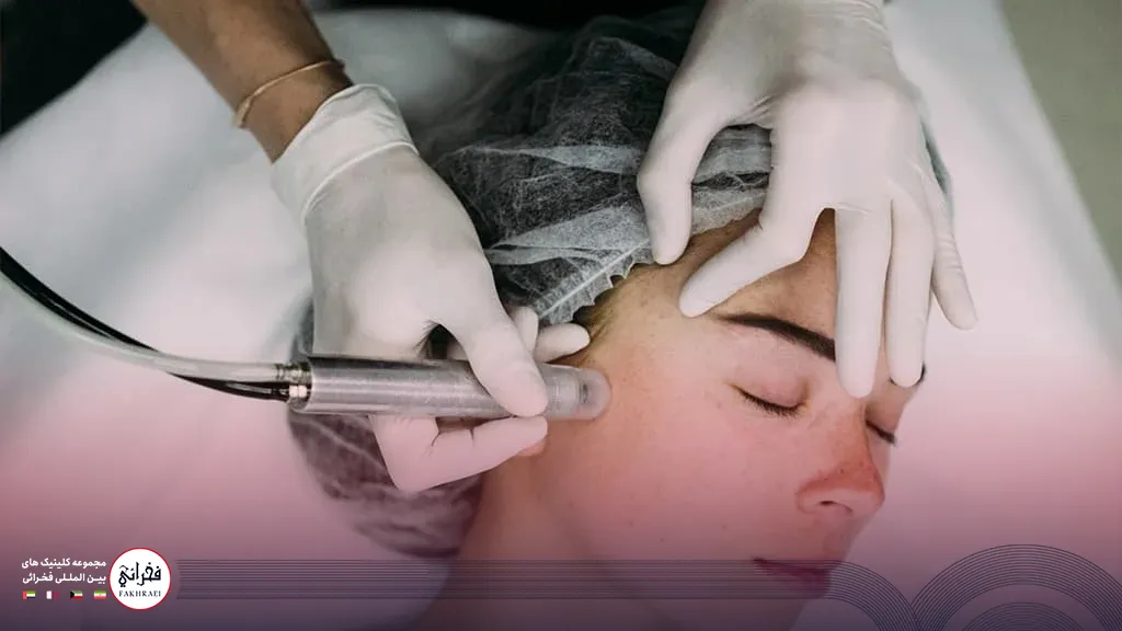 تصویر زنی در حال میکرونیدلینگ صورت