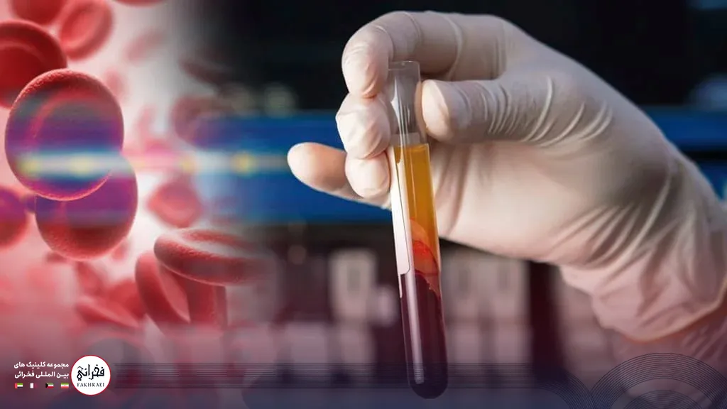 کیت پی آر پی