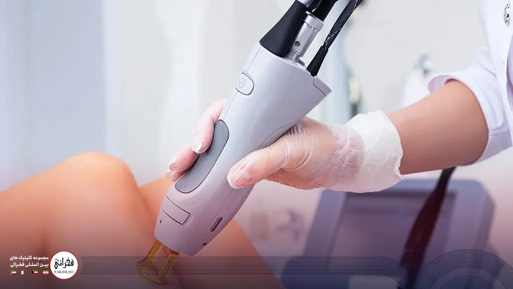 آیا دستگاه لیزر کندلا خوب است؟