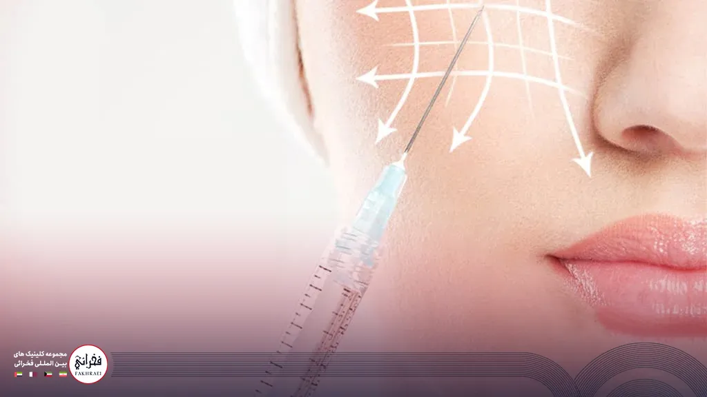 تزریق فیلر