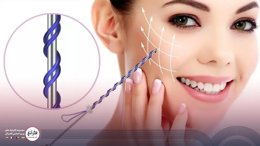 انواع نخ های لیفت با نخ