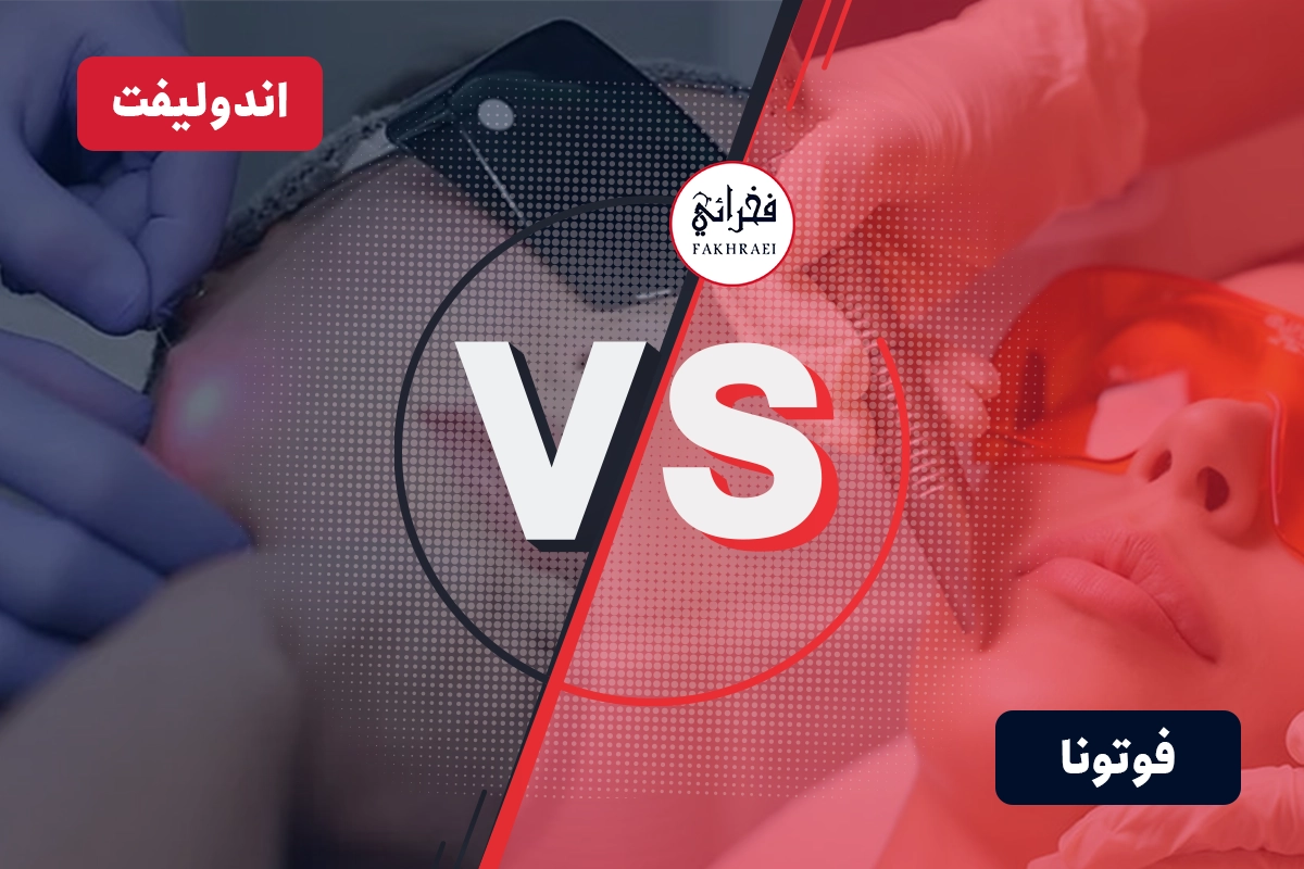 مقایسه لیزر فوتونا و اندولیفت