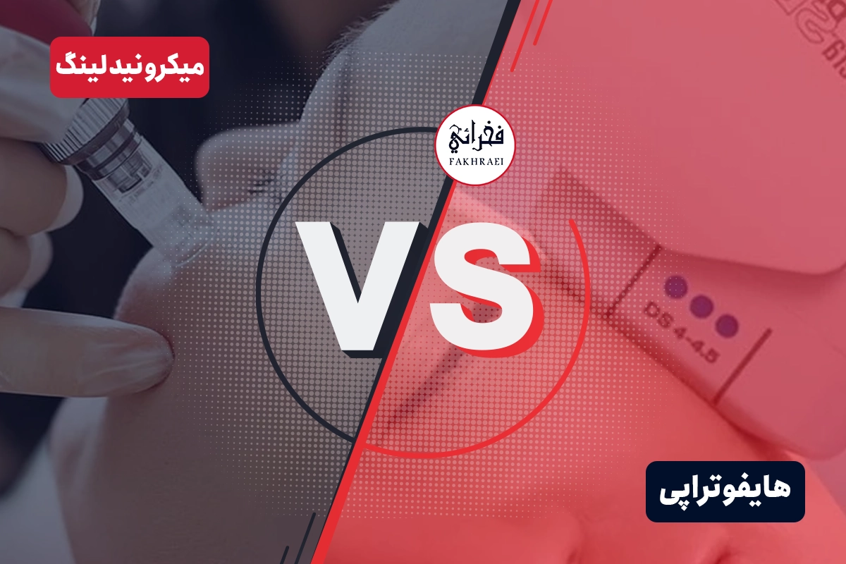 مقایسه هایفو و میکرونیدلینگ