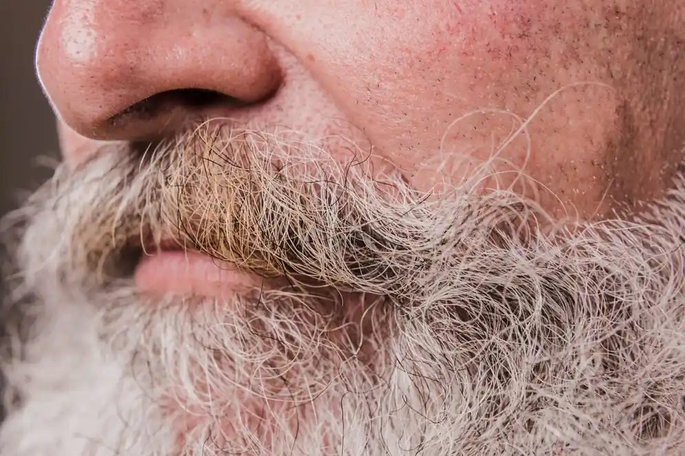 کاشت ریش روی جای زخم