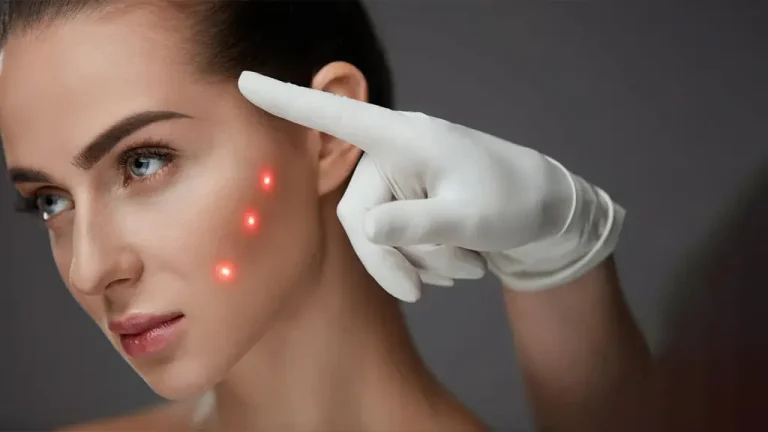 لیزر CO2 چیست؟ و برای چه مواردی استفاده میشود؟