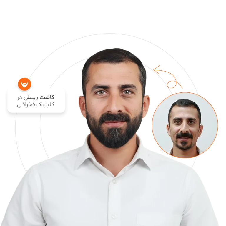 کاشت ریش در کلینیک فخرائی