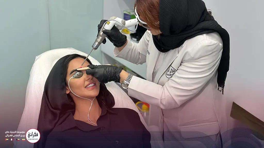 پاک کردن تتو ابرو با لیزر کیوسوییچ در کلینیک فخرائی