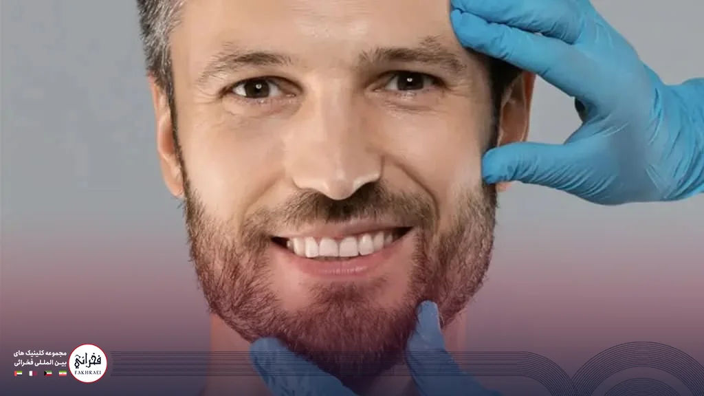 اقدامات پیش از کاشت ریش