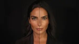 قبل و بعد تزریق بوتاک چشم گربه ای