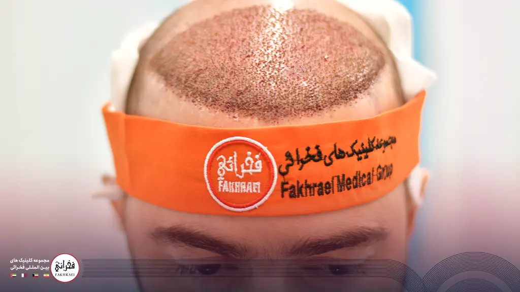 ناحیه کاشته شده بعد از کاشت در کلینیک فخرائی