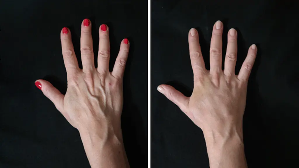 کاندید مناسب جوانسازی دست