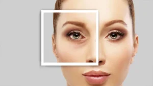 Fat-injection-under-the-eyes-p1