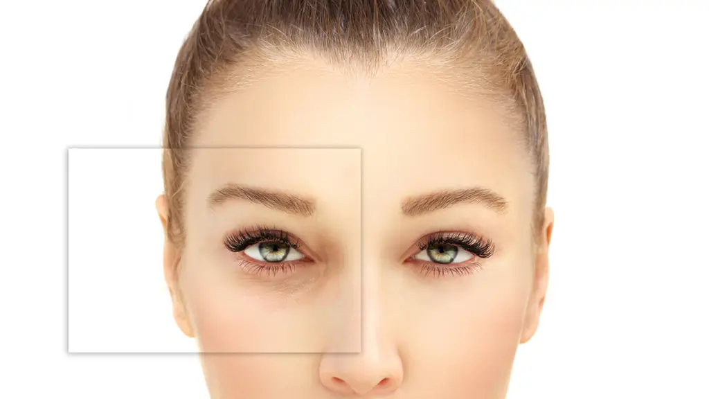 مراقبت‌های ضروری بعد از تزریق چربی 