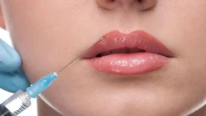 تزریق چربی به لب