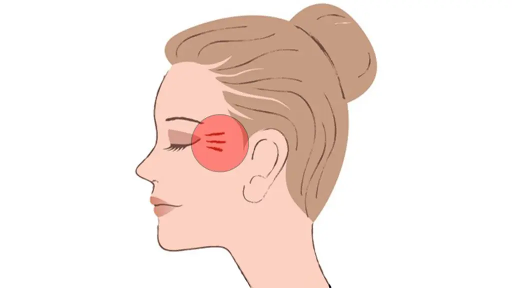 محل تزریق بوتاکس پنجه کلاغی