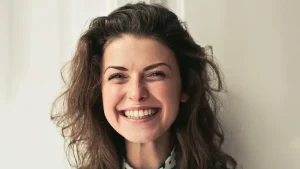 injection-filler-laugh-line-7