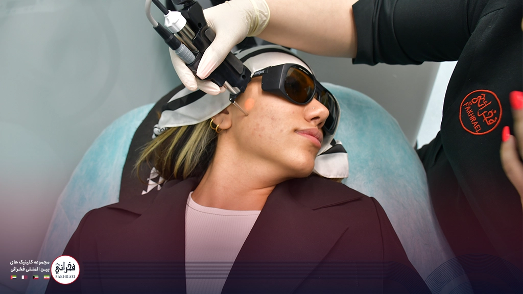 لیزر صورت با دستگاه لیزر سایناشور الیت پلاس