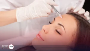 تزریق فیلر پیشانی