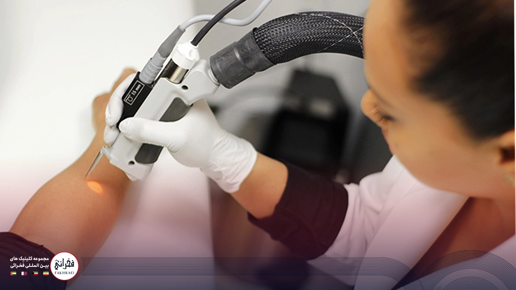 لیزر سایناشور الیت پلاس