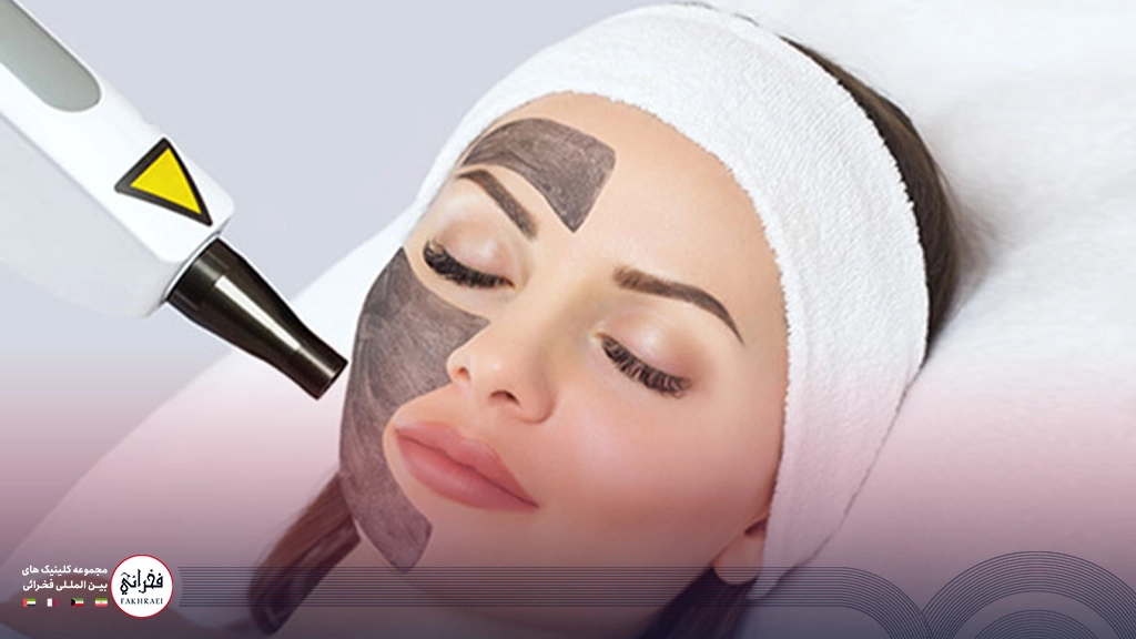 لیزر کیوسوئیچ برای لک صورت- زنی با چشمان بسته در حال انجام لیزر برروی او