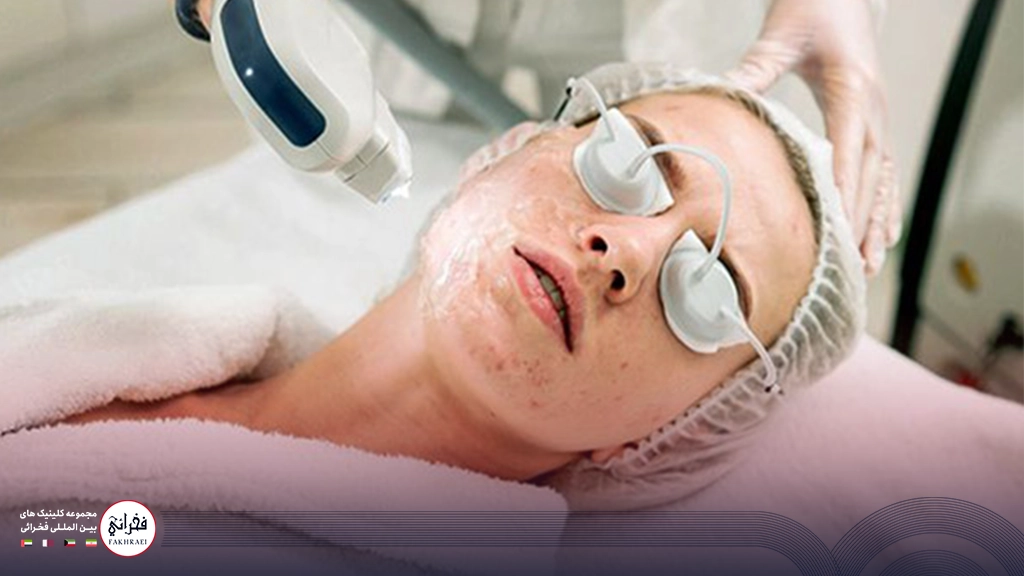 لیزر کیوسوئیچ برای لک صورت- زنی با چشم بند زیر دستگاه لیزر