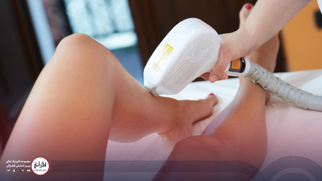 لیزر موهای زائد با دستگاه سایناشور