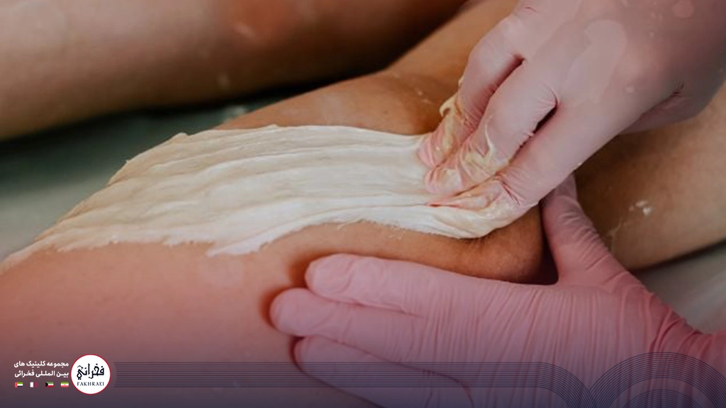 روش های خانگی از بین بردن موهای زائد