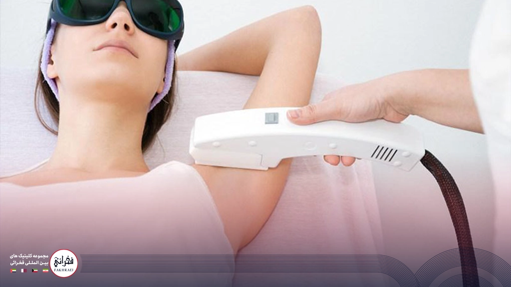 لیزر کیوسوئیچ برای زیر بغل- زنی در حال انجام لیزر زیر بغل